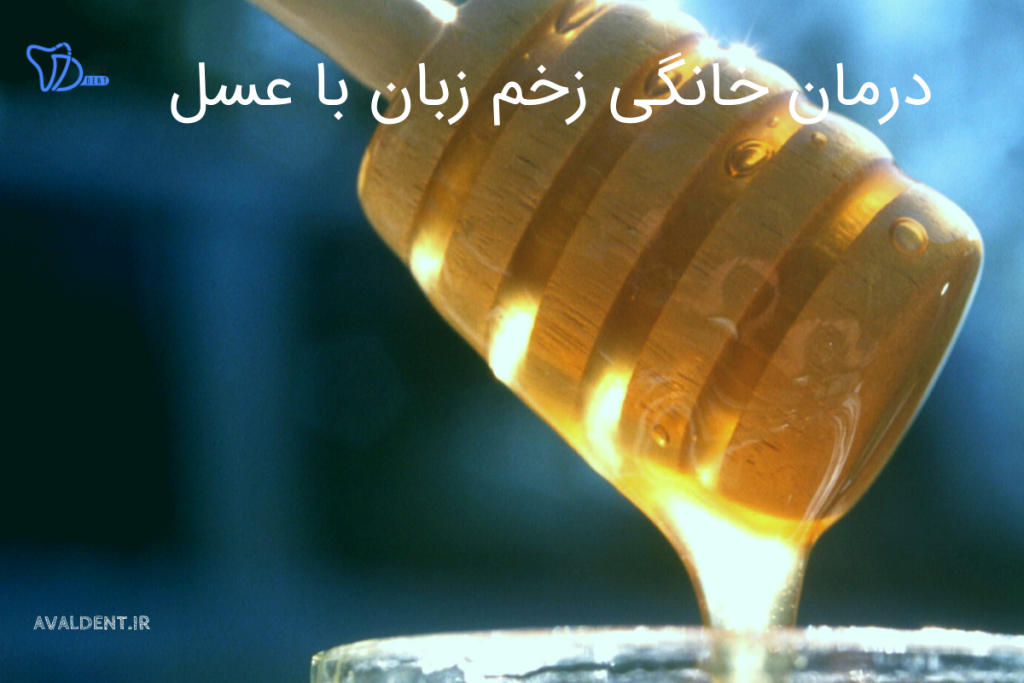 درمان خانگی با عسل