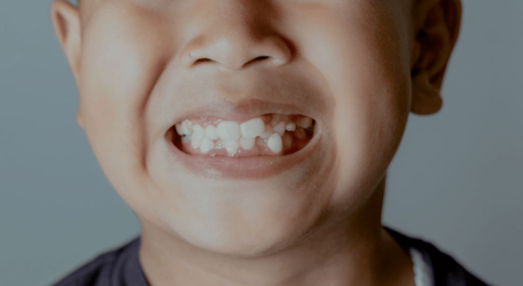 ژنتیک چگونه روی دندان های شما تأثیر می گذارد؟