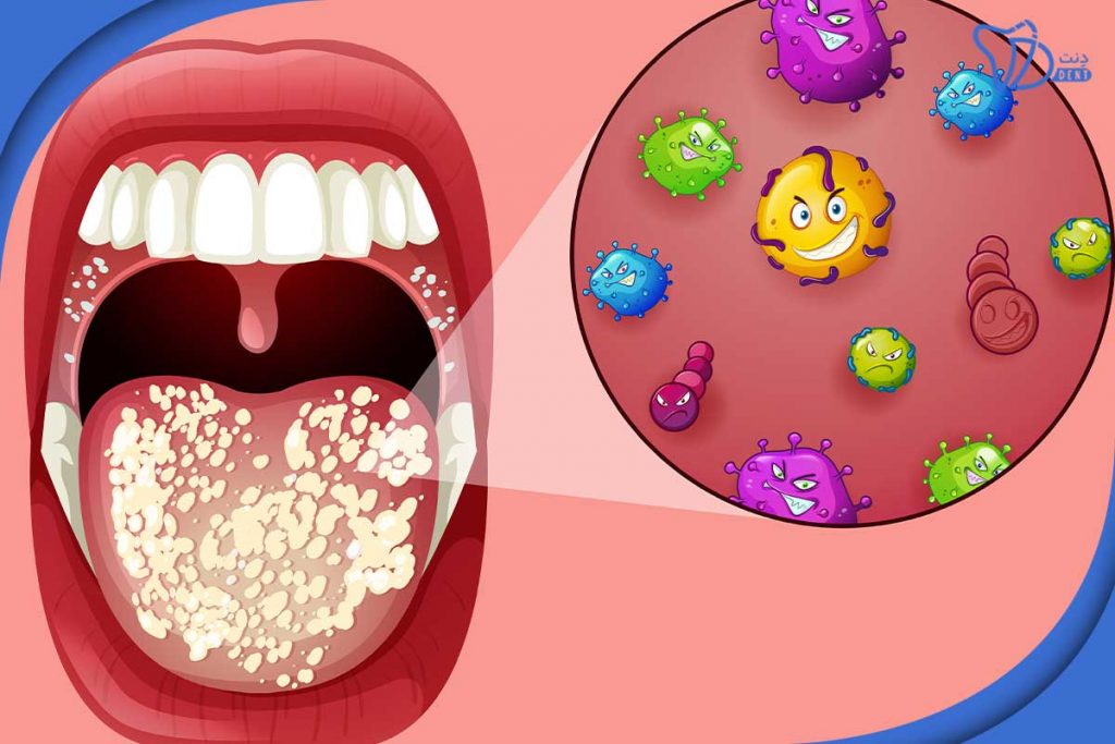 چگونه باکتری های دهان محافظت در برابر رشد ویروس را سرکوب می‌کنند؟