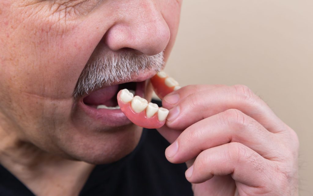 مشکل اصلی بی دندانی و سریعترین روش درمان