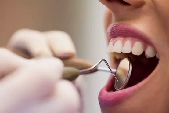 آینه دندانپزشکی(دهانی)